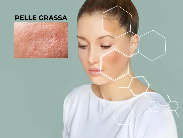 Skin Care per Pelle Grassa (Guida)